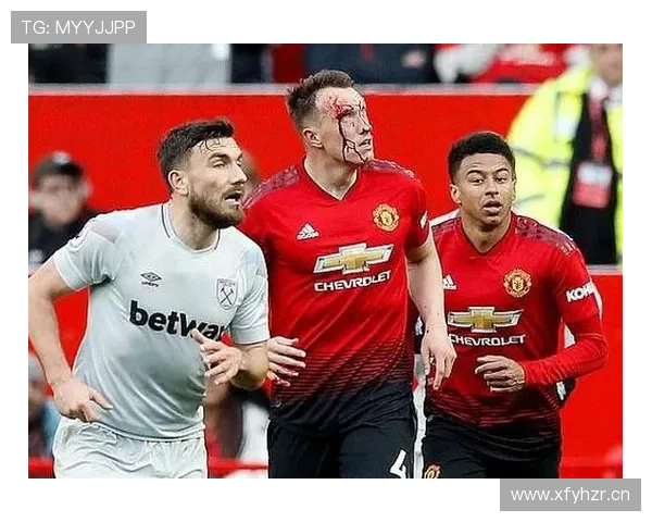 曼联阵容越拼越乱，临时凑战组合难掩体系缺失